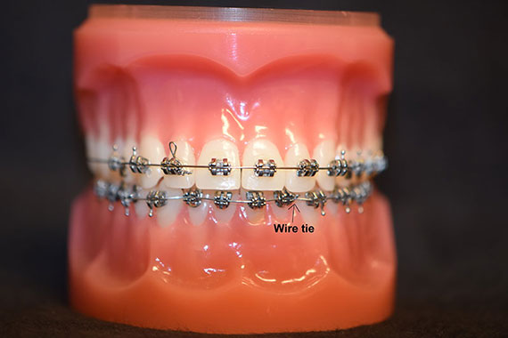 Orthodontic Care From Home